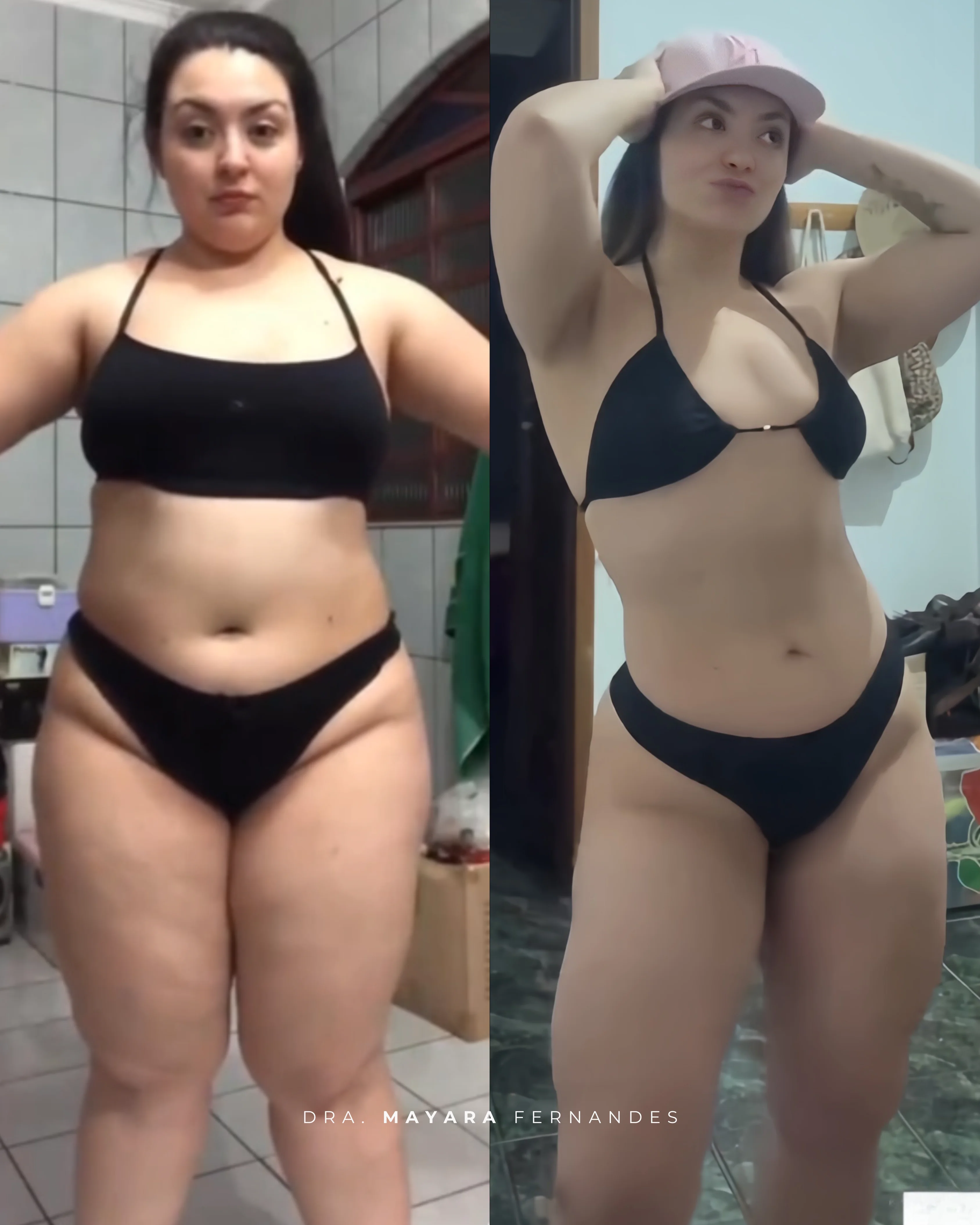 Resultado CrioShape Moriah